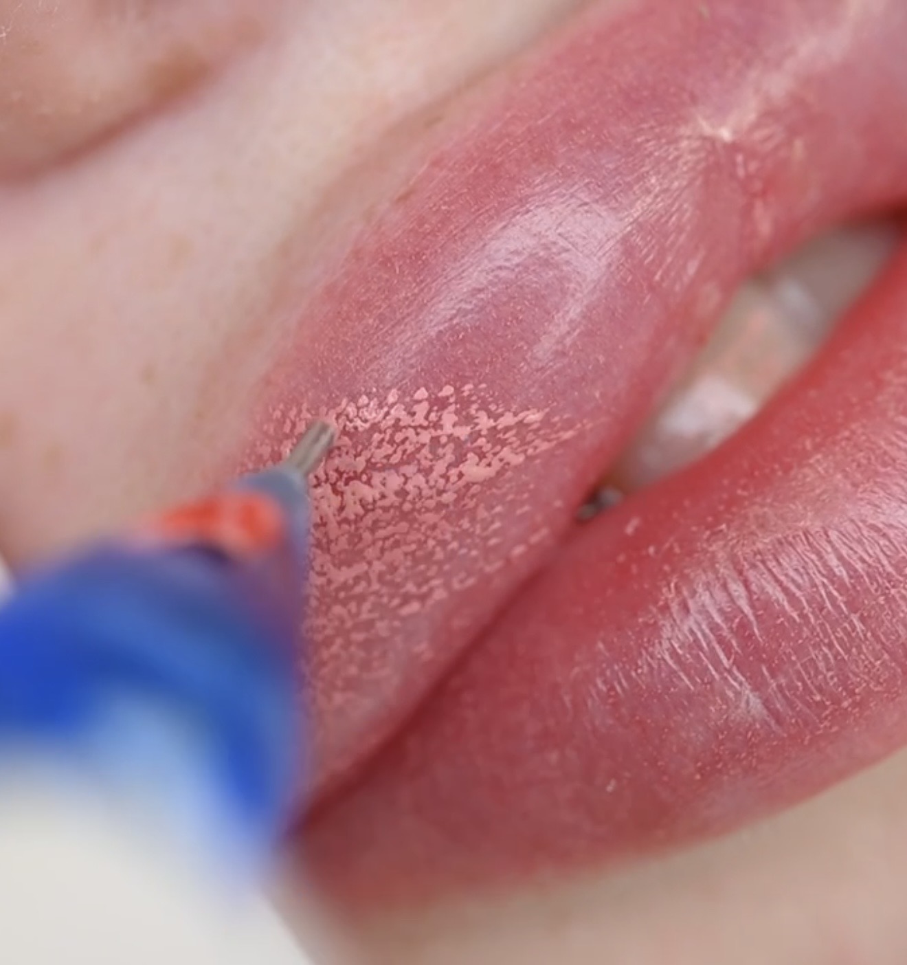 Ajak pigmentálása élő modellen